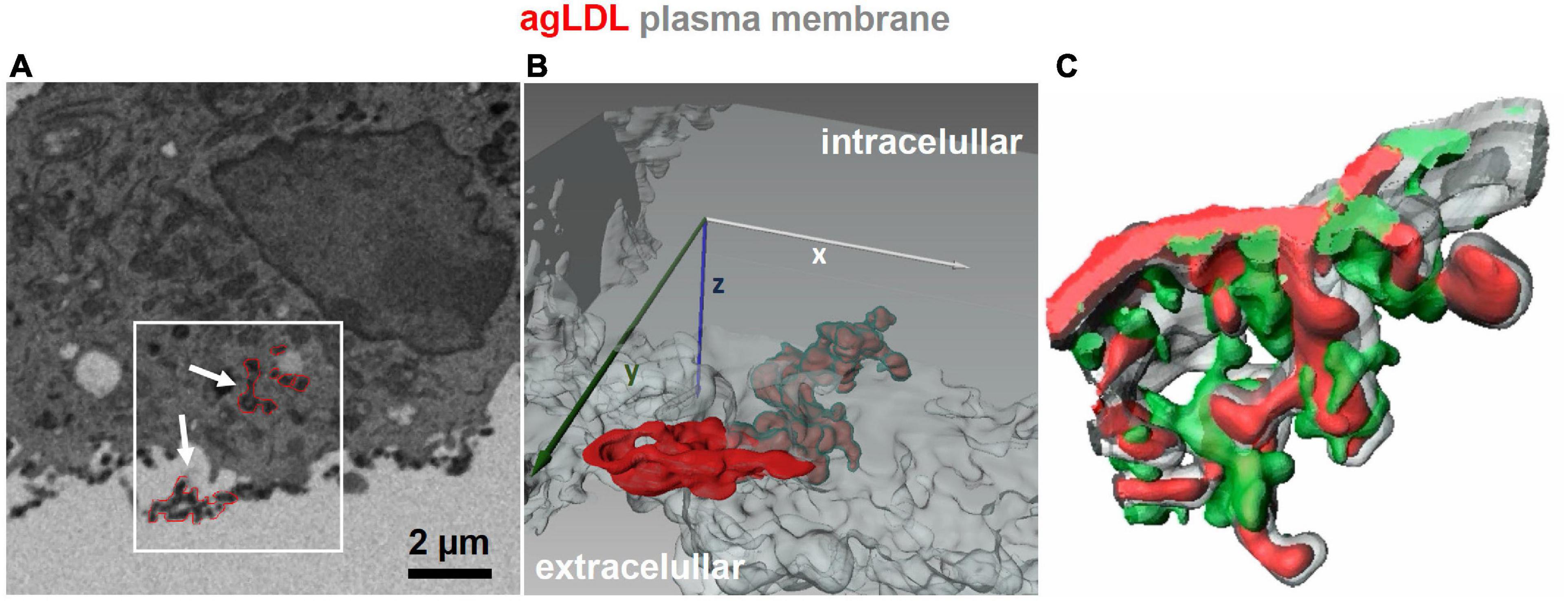 The formation and consequences of cholesterol-rich deposits in atherosclerotic lesions